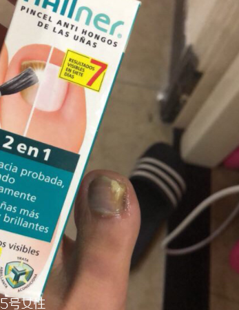 灰甲清有副作用嗎？灰甲清有哪些副作用？