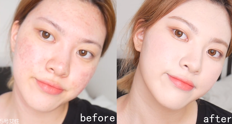 大面積痘印怎么遮瑕 大面積痘印底妝遮瑕教程 大面積痘印怎么遮瑕 大面積痘印底妝遮瑕教程