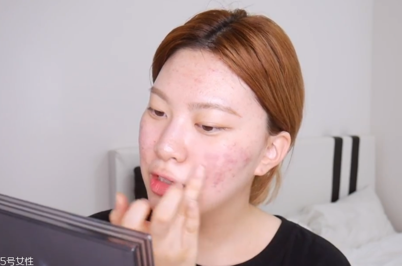 大面積痘印怎么遮瑕 大面積痘印底妝遮瑕教程 大面積痘印怎么遮瑕 大面積痘印底妝遮瑕教程