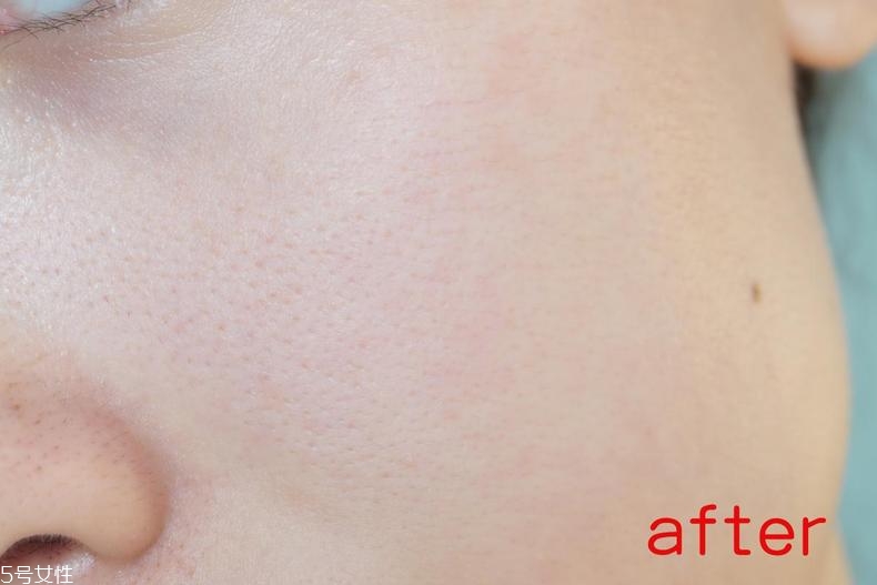 radha beauty vc精華白天能用嗎？敏感肌能用嗎？