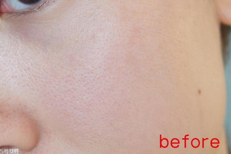 radha beauty vc精華白天能用嗎？敏感肌能用嗎？