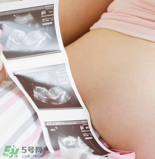 頭胎雙胞胎還能生二胎嗎？雙胞胎家庭能要二胎嗎？