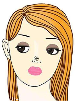 黑頭不管它會變大嗎？黑頭不管它會怎樣？