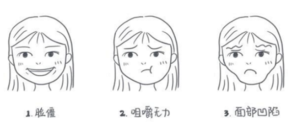 瘦臉針副作用多久出現(xiàn) 瘦臉針的過(guò)程 瘦臉針副作用多久出現(xiàn) 瘦臉針的過(guò)程