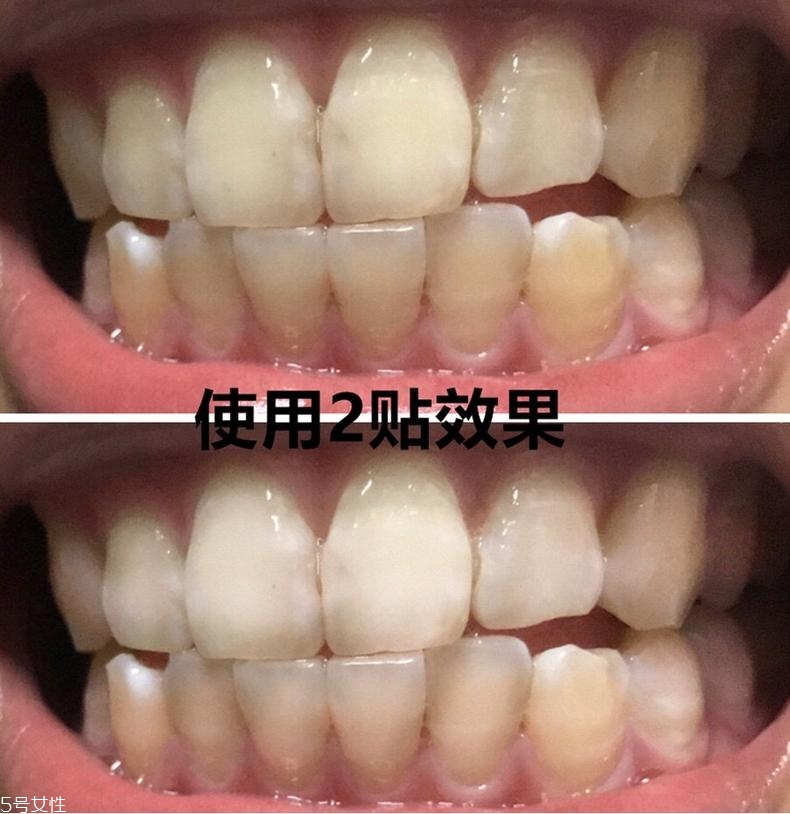 佳潔士美白牙貼貼多久有效？佳潔士美白牙貼使用感受