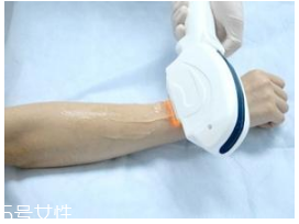 激光脫毛脫幾次干凈 激光脫毛效果因人而異 激光脫毛脫幾次干凈 激光脫毛效果因人而異