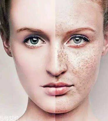 皮秒會反黑嗎 這是正?，F(xiàn)象