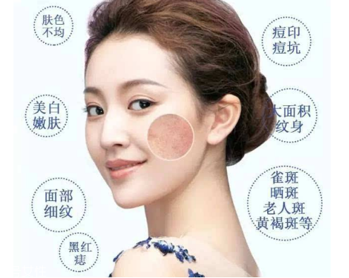 皮秒會反黑嗎 這是正?，F(xiàn)象