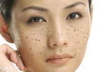 皮秒為什么那么貴 貴是因?yàn)檫@些原因 皮秒為什么那么貴 貴是因?yàn)檫@些原因