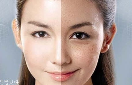 皮秒為什么那么貴 貴是因?yàn)檫@些原因 皮秒為什么那么貴 貴是因?yàn)檫@些原因