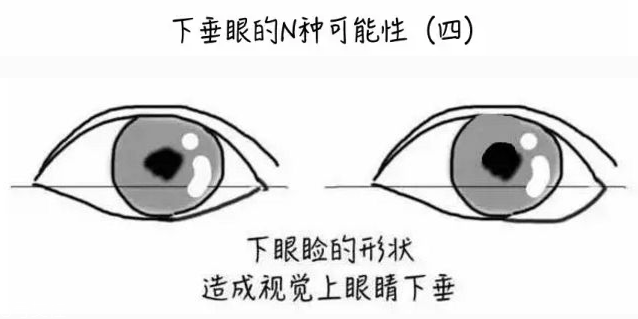 下垂眼怎么畫(huà)眼線(xiàn) 這么畫(huà)擺脫喪氣