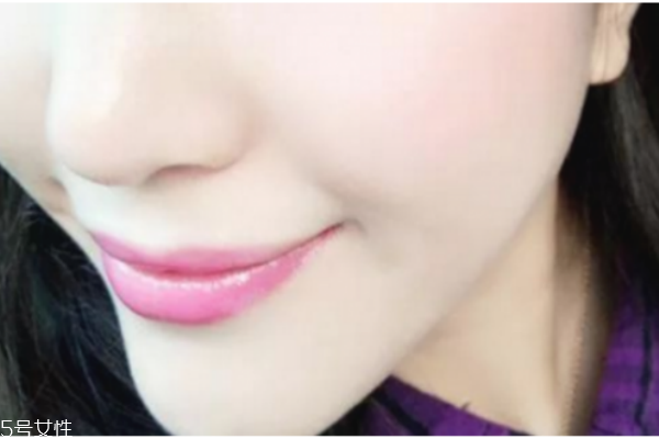 唇紋深是什么原因 教你輕松消除唇紋 唇紋深是什么原因 教你輕松消除唇紋