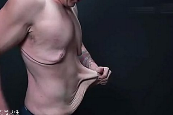 皮膚松弛，你應(yīng)該為肌膚補(bǔ)充營(yíng)養(yǎng)