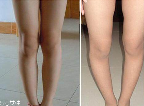 什么樣的腿算長(zhǎng) 你知道怎樣是真正的腿精 什么樣的腿算長(zhǎng) 你知道怎樣是真正的腿精