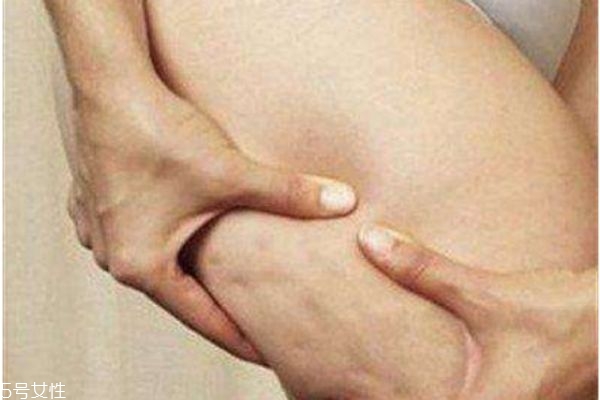 生長(zhǎng)紋自己會(huì)消失嗎 生長(zhǎng)紋和肥胖紋的區(qū)別 生長(zhǎng)紋自己會(huì)消失嗎 生長(zhǎng)紋和肥胖紋的區(qū)別