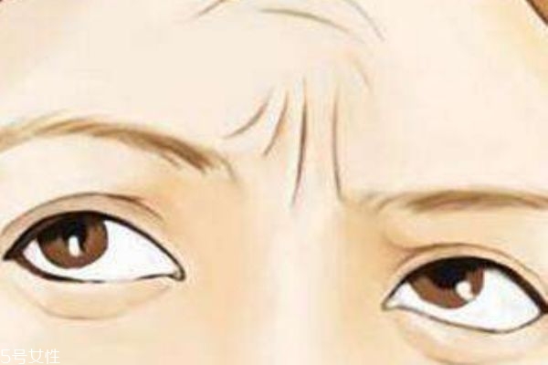 川字紋怎么消除 川字紋是什么 川字紋怎么消除 川字紋是什么