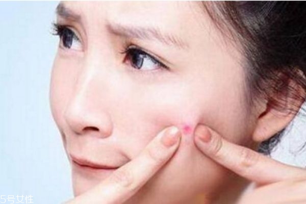 經(jīng)常熬夜臉上長(zhǎng)痘痘怎么辦 熬夜起痘痘怎么調(diào)理 經(jīng)常熬夜臉上長(zhǎng)痘痘怎么辦 熬夜起痘痘怎么調(diào)理