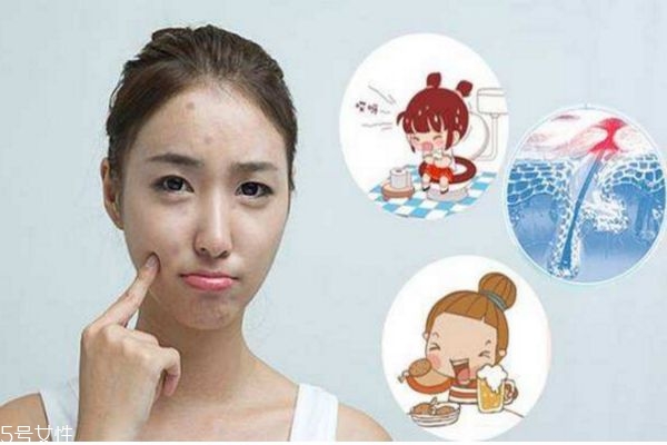 經(jīng)常熬夜臉上長(zhǎng)痘痘怎么辦 熬夜起痘痘怎么調(diào)理 經(jīng)常熬夜臉上長(zhǎng)痘痘怎么辦 熬夜起痘痘怎么調(diào)理