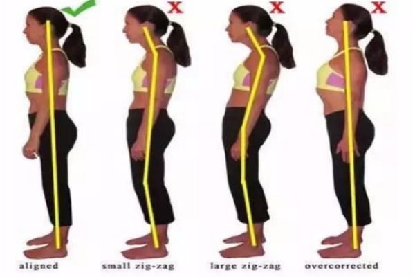 膝蓋超伸是怎么引起的 如何自查是否膝超伸 膝蓋超伸是怎么引起的 如何自查是否膝超伸