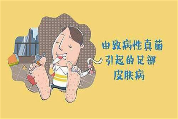 灰指甲癥狀是什么 原因是這樣 灰指甲癥狀是什么 原因是這樣