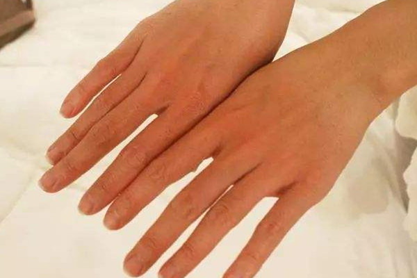 防曬指數(shù)怎么計算 防嗮的方法 防曬指數(shù)怎么計算 防嗮的方法