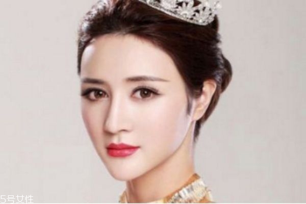 墊下巴多久可以恢復(fù) 墊下巴后多久可以吃飯 墊下巴多久可以恢復(fù) 墊下巴后多久可以吃飯