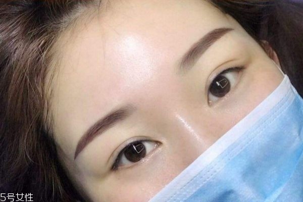 氧氣眉剛做出來(lái)的圖片 無(wú)痂輕氧眉一個(gè)星期圖