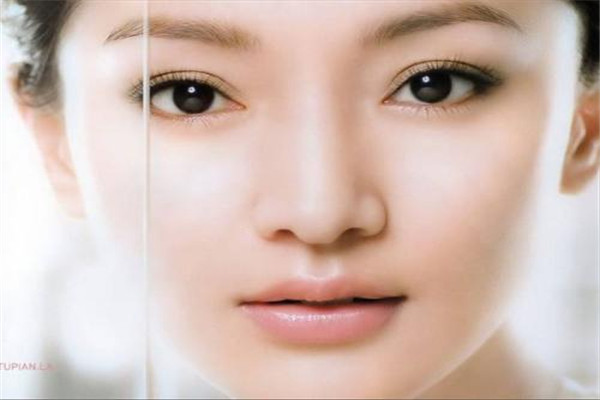 美杜莎雙眼皮是永久的嗎 美杜莎雙眼皮維持時間久嗎 美杜莎雙眼皮是永久的嗎 美杜莎雙眼皮維持時間久嗎