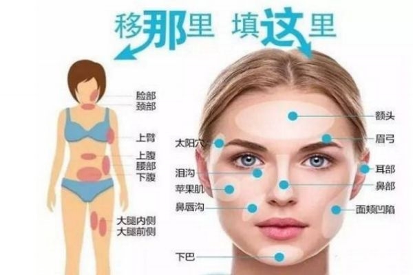 脂肪填充多久擦護(hù)膚品 脂肪填充多久用洗面奶 脂肪填充多久擦護(hù)膚品 脂肪填充多久用洗面奶