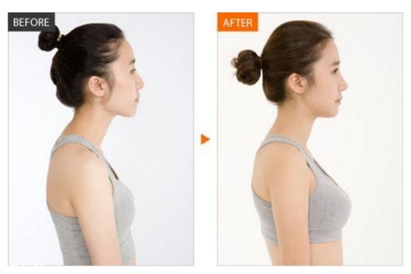 假體隆胸多久變軟 怎樣使假體隆胸手感更真實(shí) 假體隆胸多久變軟 怎樣使假體隆胸手感更真實(shí)