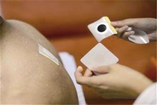 三伏貼多少錢(qián)一張 按療程治療 三伏貼多少錢(qián)一張 按療程治療