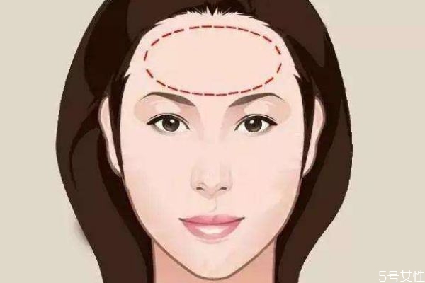 額頭太大怎么辦呢 為什么有的人額頭比較大呢 額頭太大怎么辦呢 為什么有的人額頭比較大呢