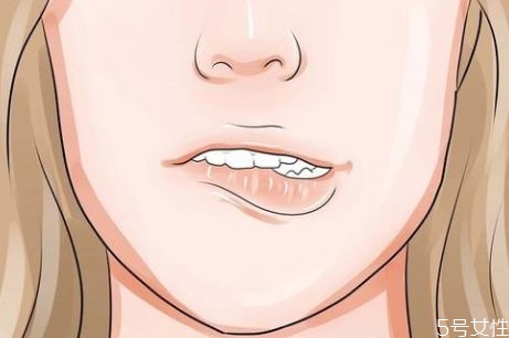 什么是唇膜炎 唇膜炎的癥狀有什么 什么是唇膜炎 唇膜炎的癥狀有什么