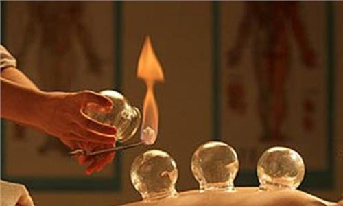 拔罐減肥需要每天拔嗎 拔罐減肥拔哪些部位