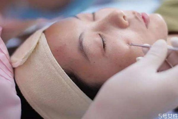 針清后需要化妝怎么辦 針清后多久可以化妝 針清后需要化妝怎么辦 針清后多久可以化妝