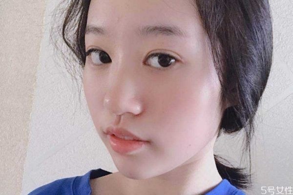 玻尿酸隆鼻后的注意事項 玻尿酸隆鼻后怎么護(hù)理