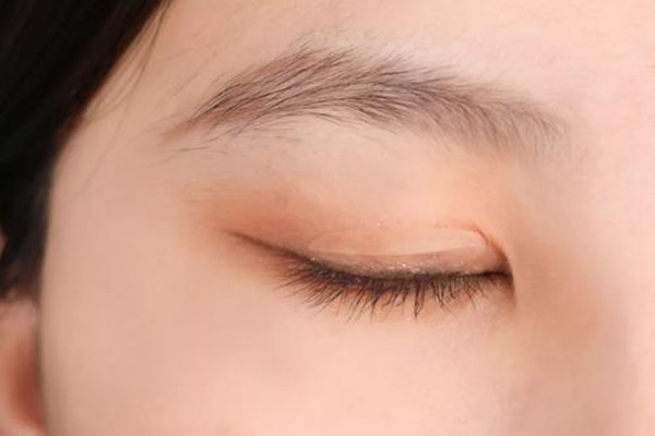 腫泡眼貼什么雙眼皮貼好 腫泡眼適合什么樣的雙眼皮貼 腫泡眼貼什么雙眼皮貼好 腫泡眼適合什么樣的雙眼皮貼