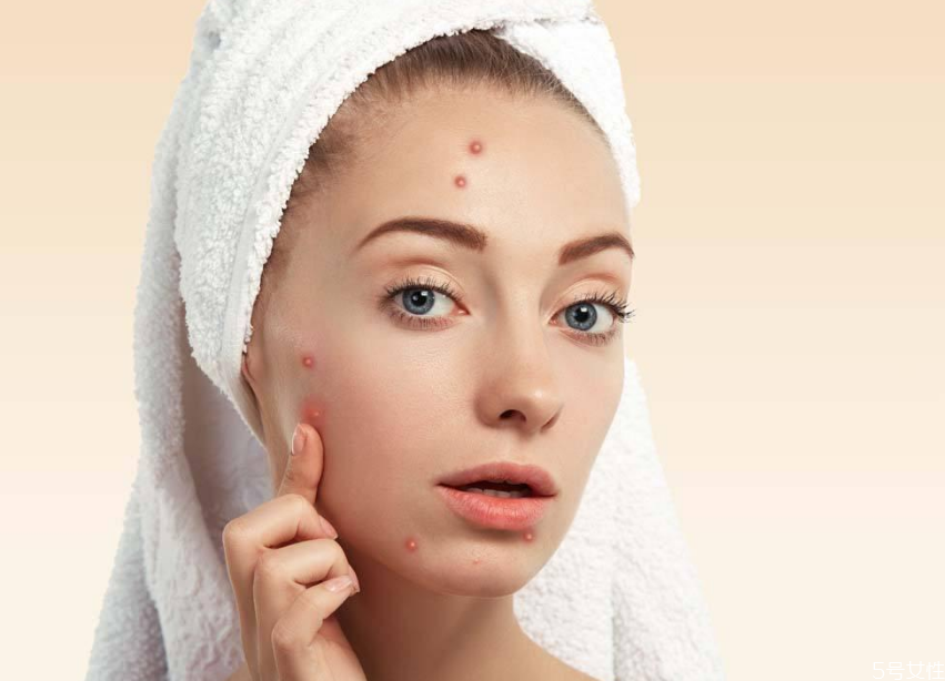 戴口罩下巴長痘痘怎么辦 怎樣避免戴口罩悶痘 戴口罩下巴長痘痘怎么辦 怎樣避免戴口罩悶痘