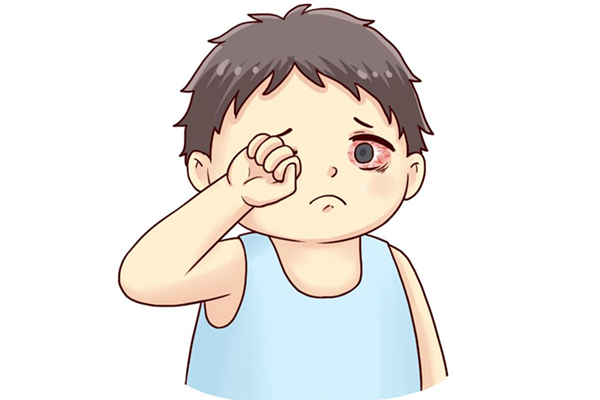 上火眼睛有什么癥狀 上火眼睛充血怎么辦 上火眼睛有什么癥狀 上火眼睛充血怎么辦