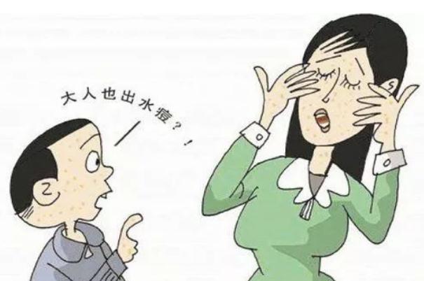 水痘要打點滴嗎 水痘要吃藥嗎 水痘要打點滴嗎 水痘要吃藥嗎