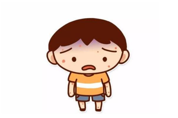 水痘要打點滴嗎 水痘要吃藥嗎 水痘要打點滴嗎 水痘要吃藥嗎