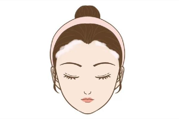發(fā)際線和發(fā)量有關系嗎 發(fā)際線和經常熬夜有關嗎