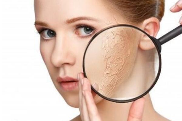 皮膚干燥脫皮嚴(yán)重像魚(yú)鱗怎么辦 皮膚干燥起皮像魚(yú)鱗是怎么回事 皮膚干燥脫皮嚴(yán)重像魚(yú)鱗怎么辦 皮膚干燥起皮像魚(yú)鱗是怎么回事