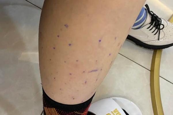 瘦腿針對脂肪腿有效果嗎 瘦腿針對身體有傷害嗎 瘦腿針對脂肪腿有效果嗎 瘦腿針對身體有傷害嗎