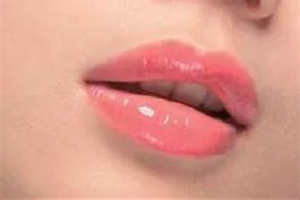 豐唇要用小分子還是大分子 豐唇用什么破尿酸比較好 豐唇要用小分子還是大分子 豐唇用什么破尿酸比較好