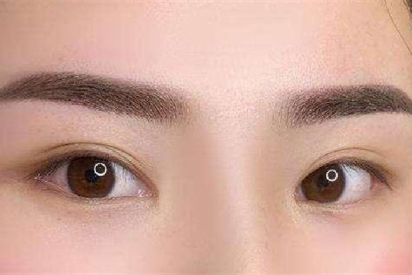 激光洗眉后的疤痕怎么修復(fù) 激光洗眉留疤是什么樣的 激光洗眉后的疤痕怎么修復(fù) 激光洗眉留疤是什么樣的