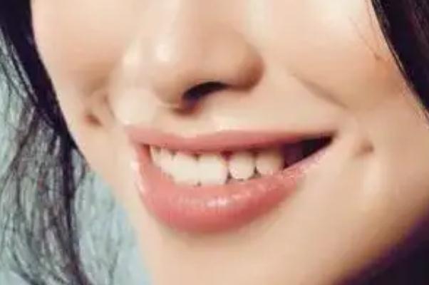 人造酒窩有點(diǎn)疼吃什么藥好 人造酒窩后如何消腫 人造酒窩有點(diǎn)疼吃什么藥好 人造酒窩后如何消腫