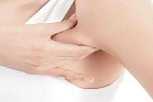 副乳切除手術(shù)是全麻還是局麻 副乳切除手術(shù)后多久可以正?；顒?dòng)