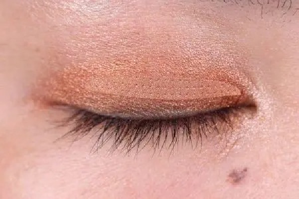 雙眼皮貼貼久了眼皮松怎么辦 雙眼皮貼有副作用嗎 雙眼皮貼貼久了眼皮松怎么辦 雙眼皮貼有副作用嗎