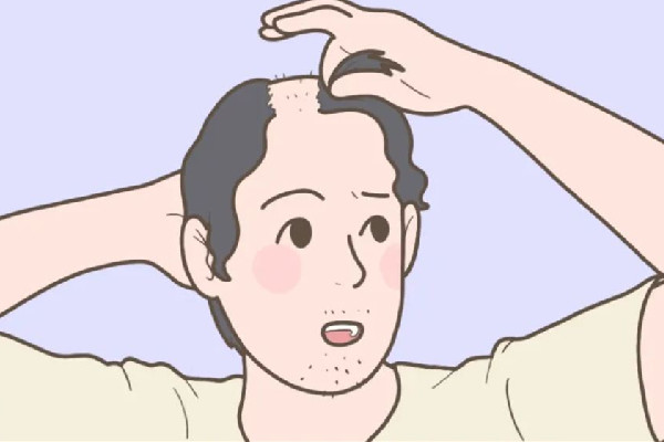 掉發(fā)吃什么食物調(diào)理 掉發(fā)吃維生素b6多久才能見(jiàn)效